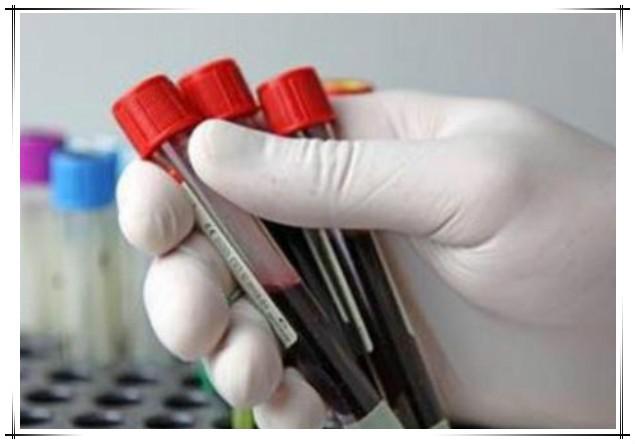 香港验血鉴定男女是通过什么鉴定的，一个验血